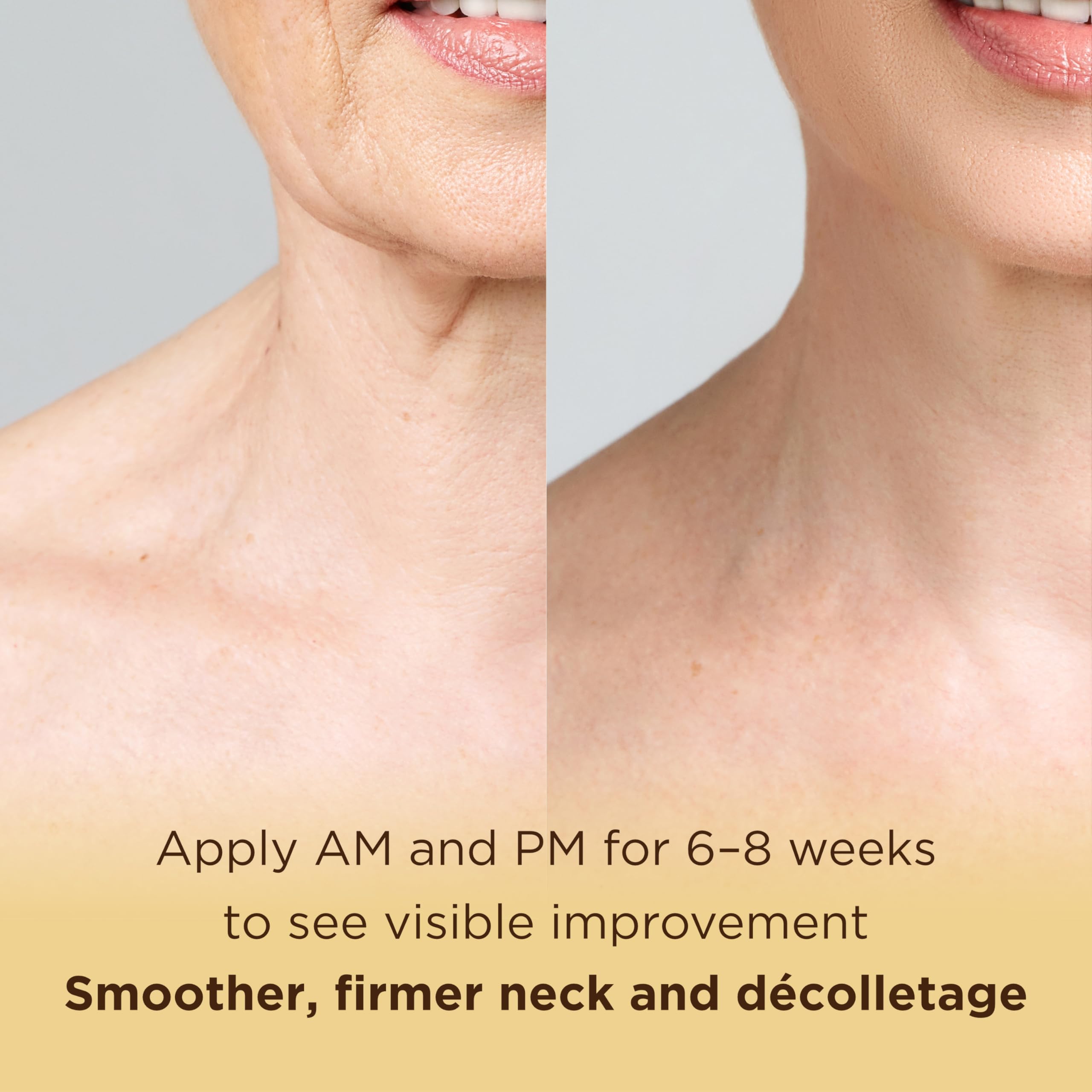 MATKAS Crème Cou Retinol Décolleté Application — soin ciblé pour le cou et le décolleté.