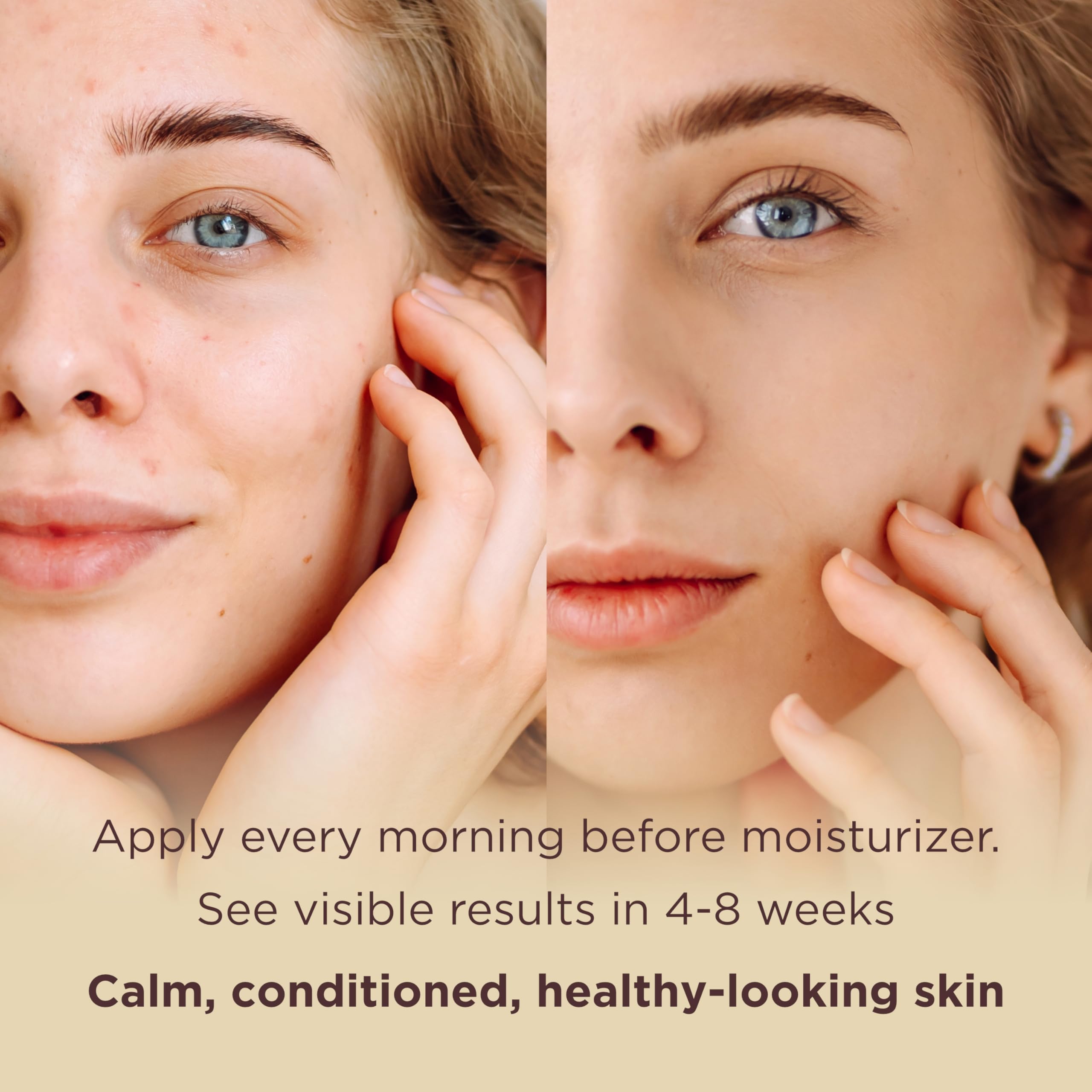 MATKAS Sérum Centella Niacinamide – teint unifié et éclat naturel après utilisation