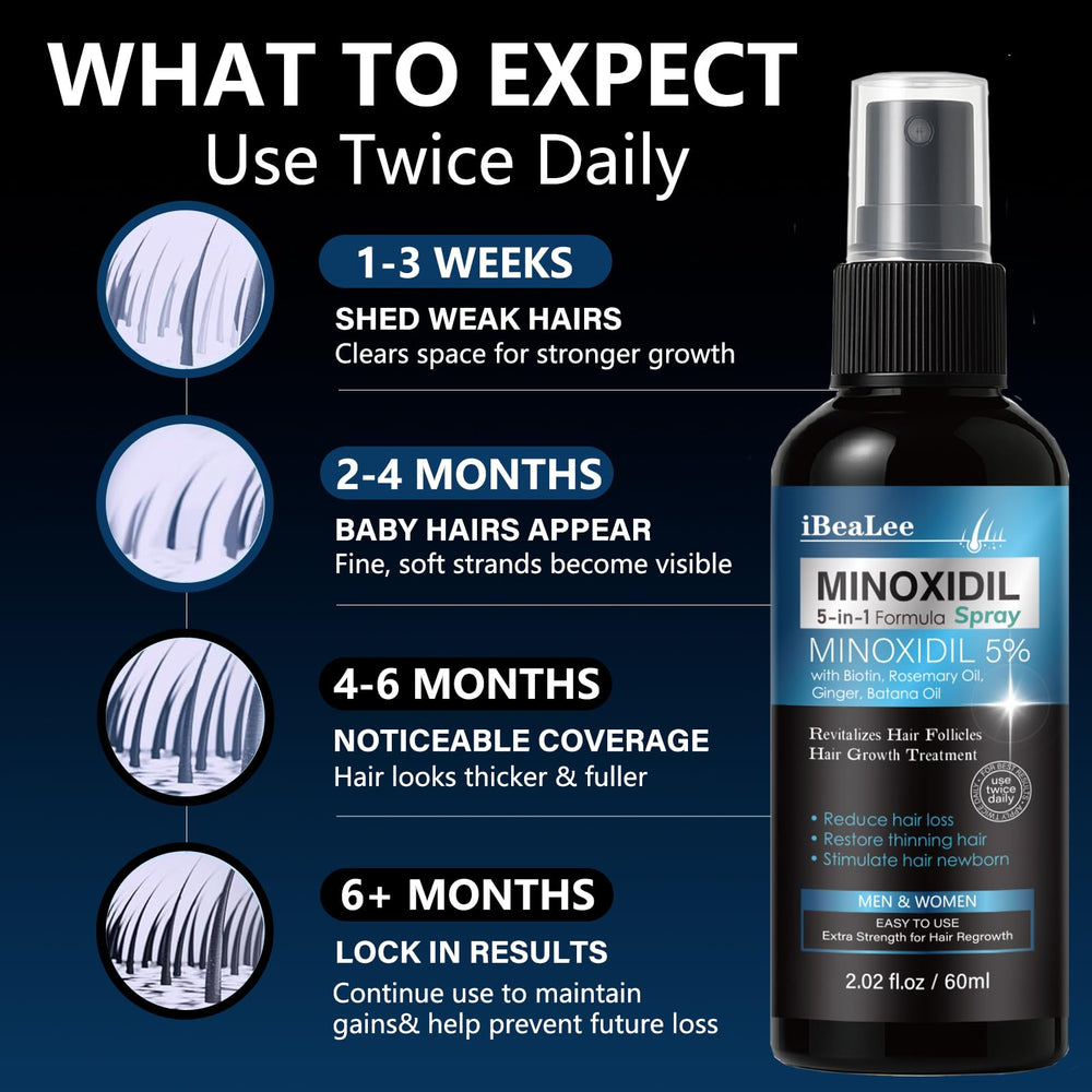 Mayferte Minoxidil: application journalière et nocturne sur cuir chevelu.