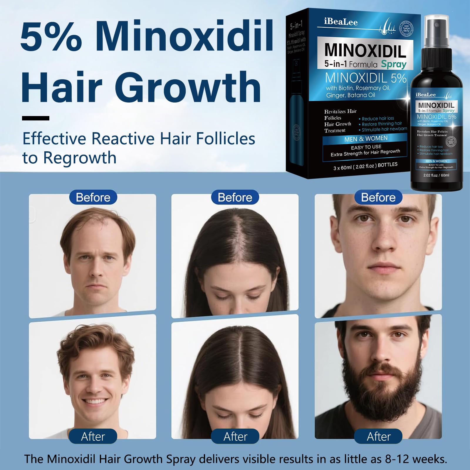 Avant-après potentiel sur cheveux avec Mayferte Minoxidil.