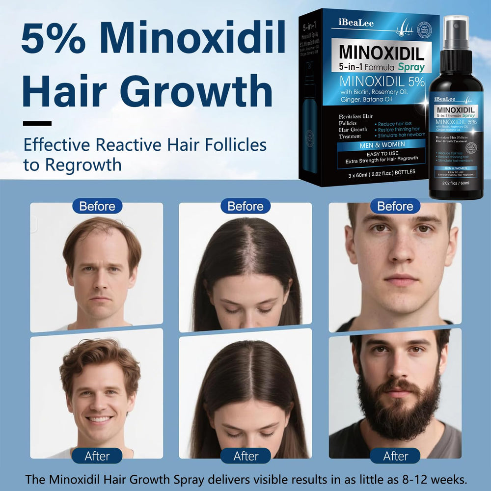 Avant-après potentiel sur cheveux avec Mayferte Minoxidil.