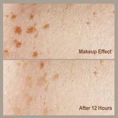 MAYKOO finition matte – taches naturelles harmonisées avec le maquillage.