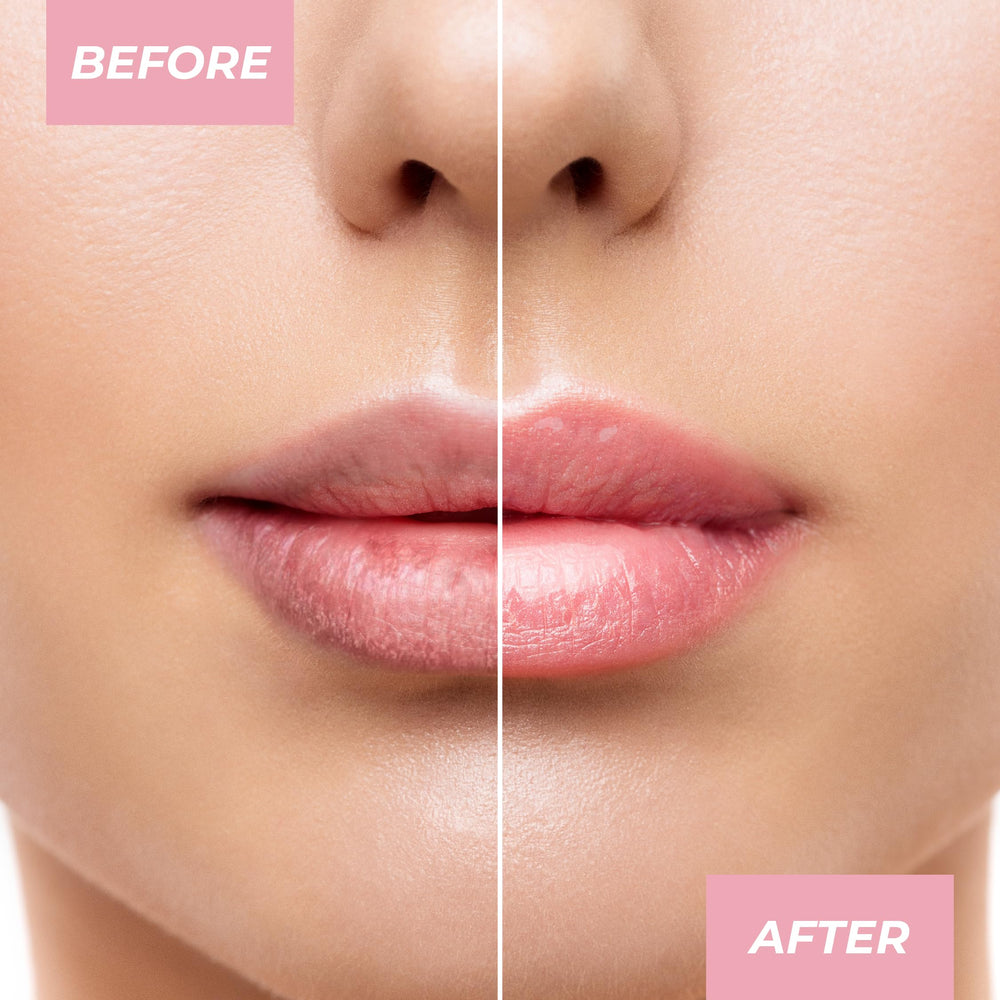 Glow Up baume à lèvres MCoBeauty offrant une hydratation durable et confort.