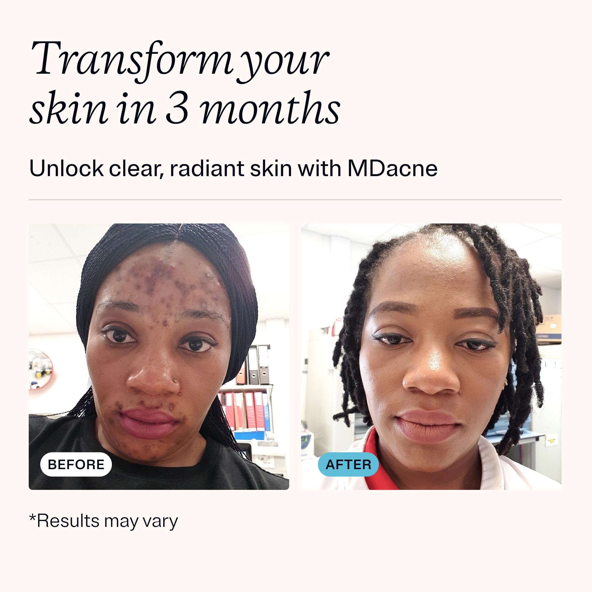 Texture crème retinol MDacne sur peau pour application douce.