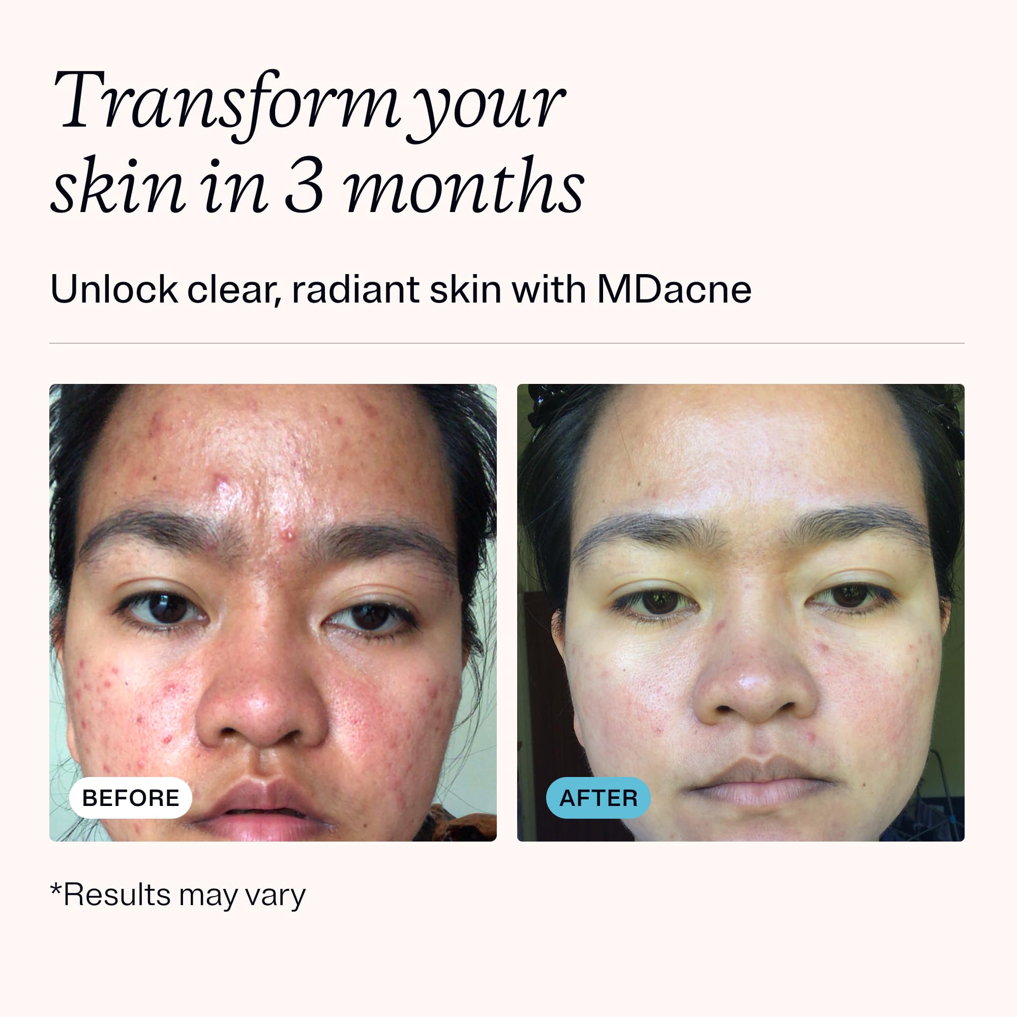 MDacne nettoyant acide salicylique 0,5% pour pores propres
