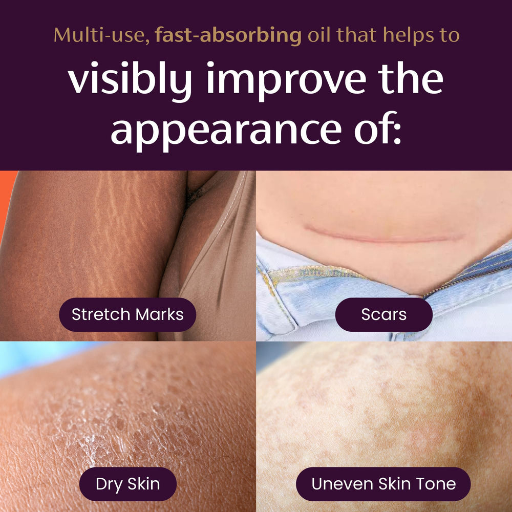 Mederma huile sans parabene et parfum: soin léger