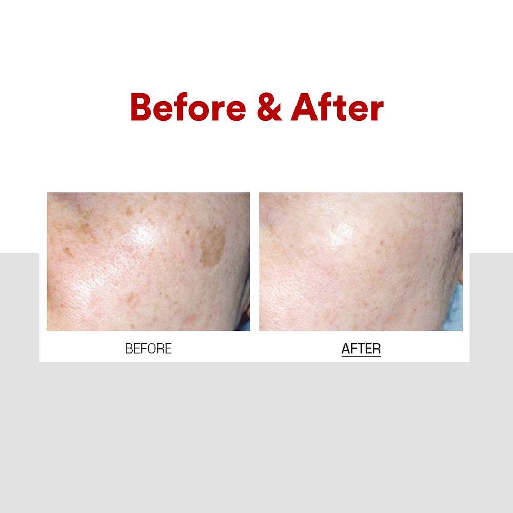 Emballage élégant et pratique de Medi-Peel Melanon X Cream