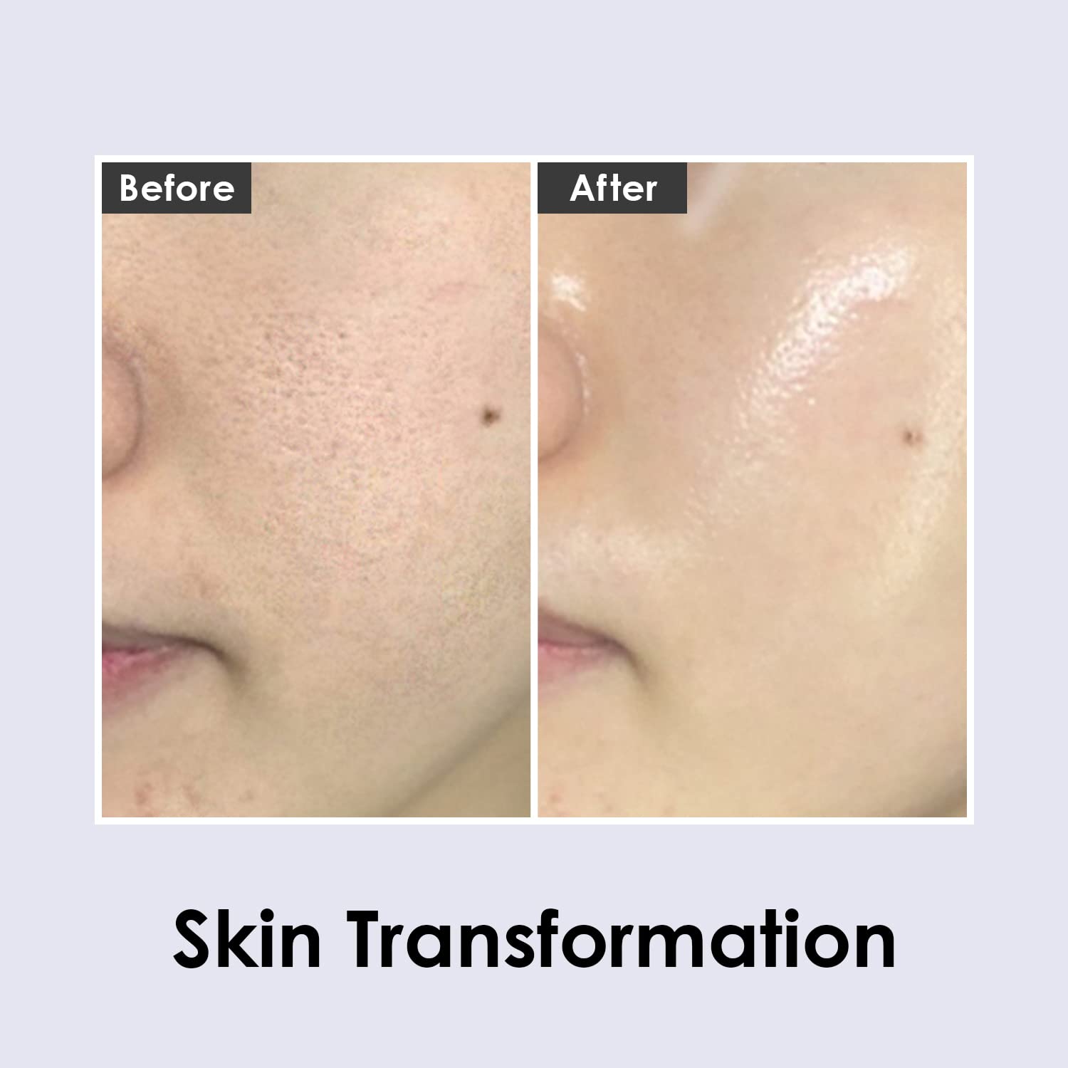 Emballage Medi-Peel Volume Tox, soin inspiré par la routine coréenne