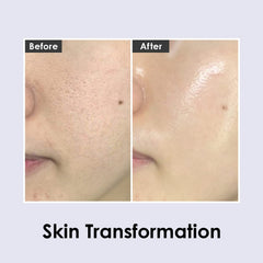 Emballage Medi-Peel Volume Tox, soin inspiré par la routine coréenne