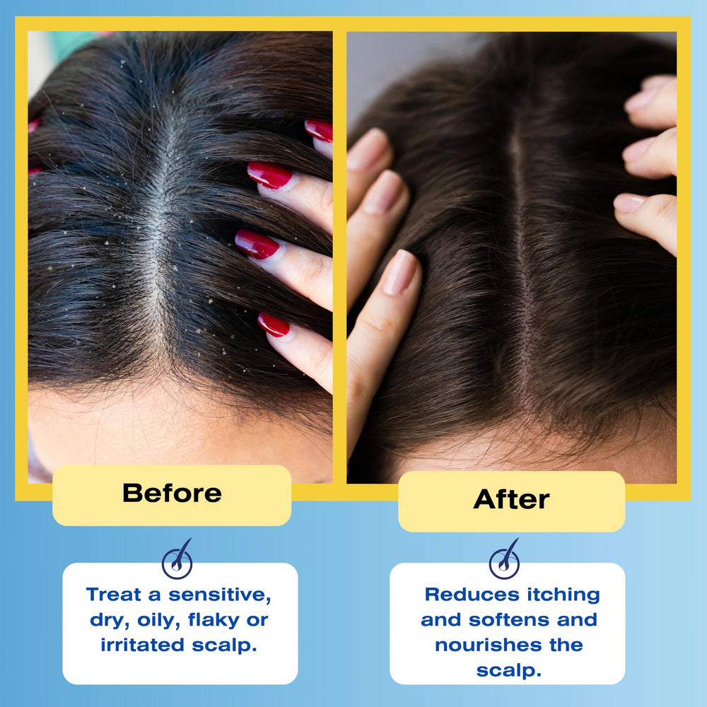 Cheveux après lavage avec le conditionneur thérapeutique Mediceuticals.