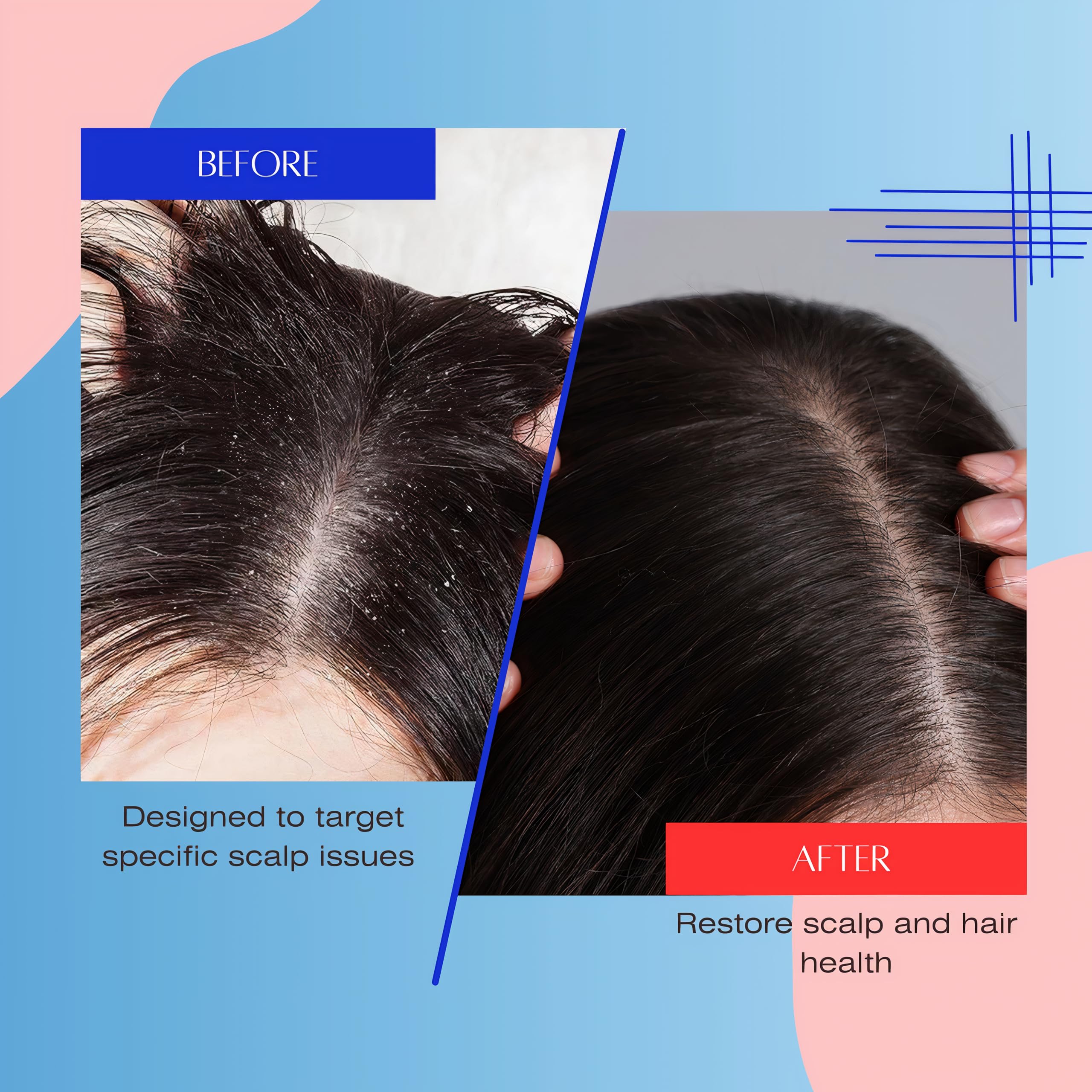 Mediceuticals Solv-X Shampoo lifestyle scene illustrating routine for healthier scalp.