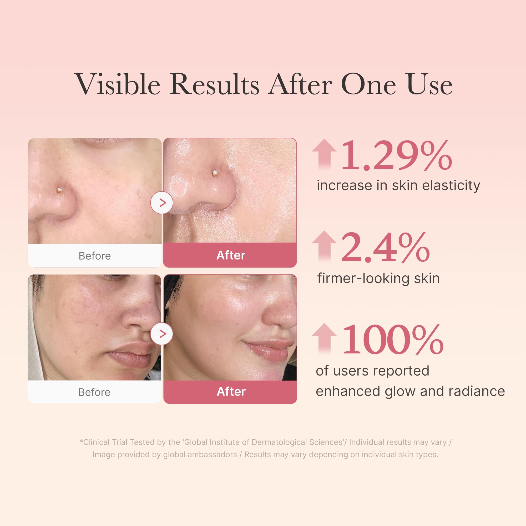 Effet éclat 24h visible sur la peau grâce au Medicube Collagen Jelly Cream.