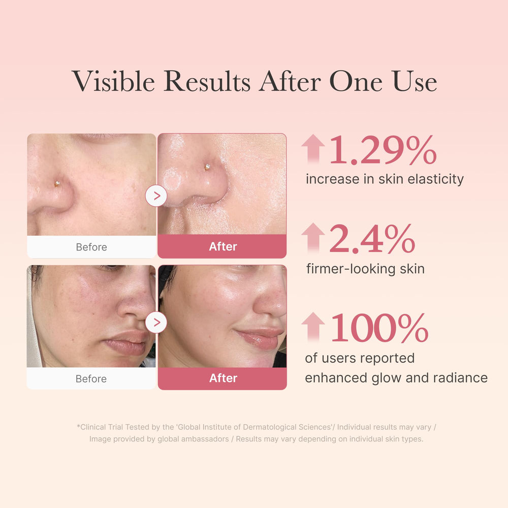 Effet éclat 24h visible sur la peau grâce au Medicube Collagen Jelly Cream.