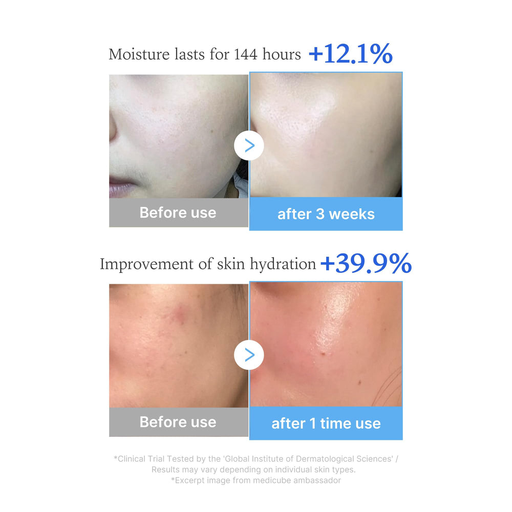 Medicube Hyaluronic Multi Peptide PDRN Serum in hand for easy daily application