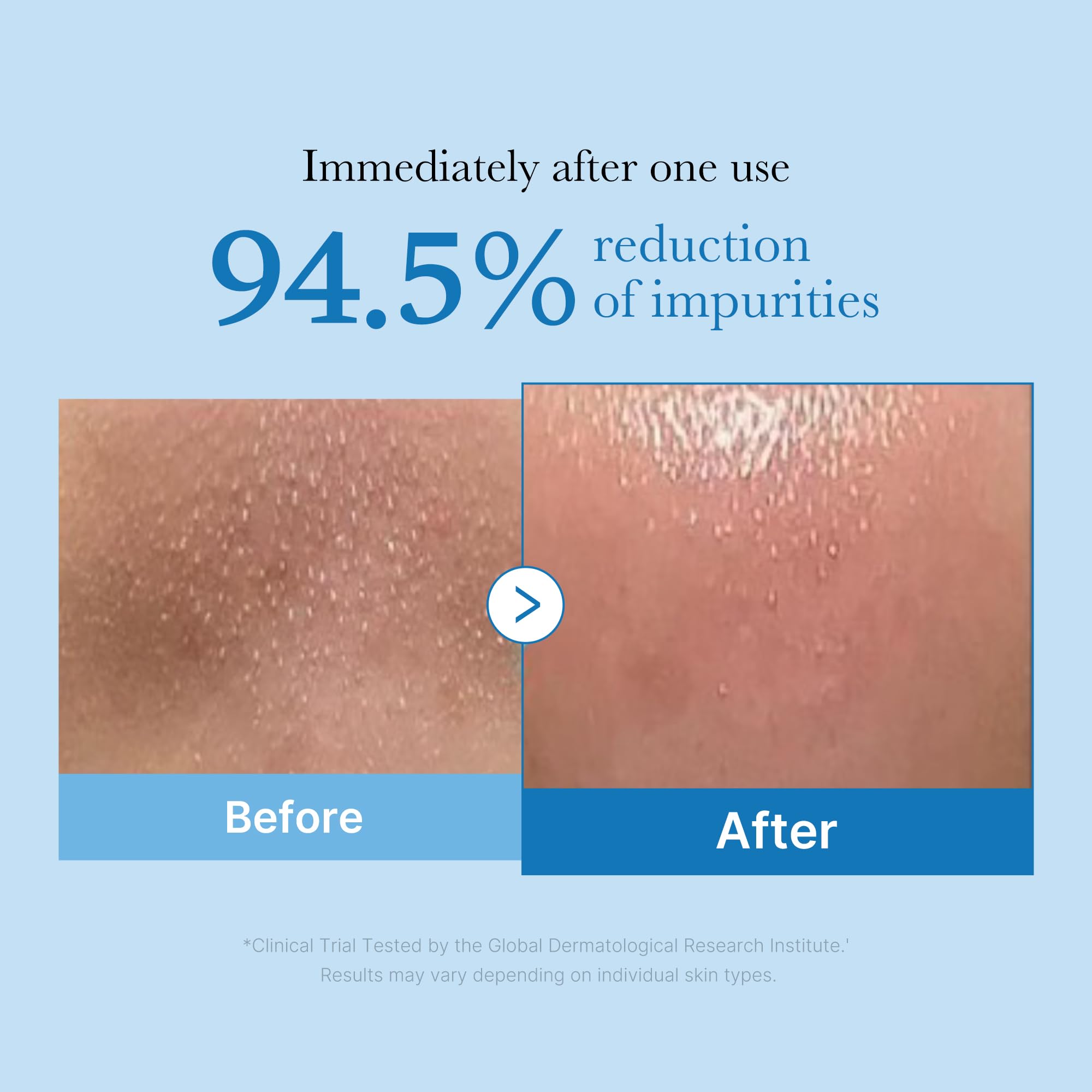 medicube Zero Pore huile demaquillante - texture huile visible et veloute