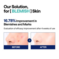 Mediheal Madecassoside Blemish Pad: tonification cutanée grâce au Madecassoside pour soin quotidien