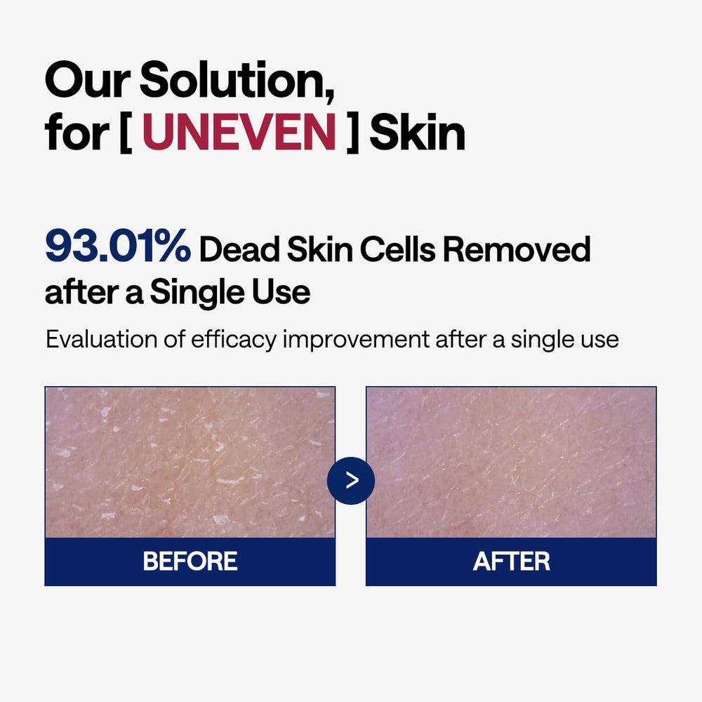 LHA et papaye dans les pads pour exfoliation efficace