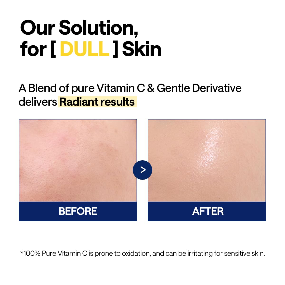 Mediheal Sérum Vitamine C — Routine soin simplifiée avec LHA et PHA.