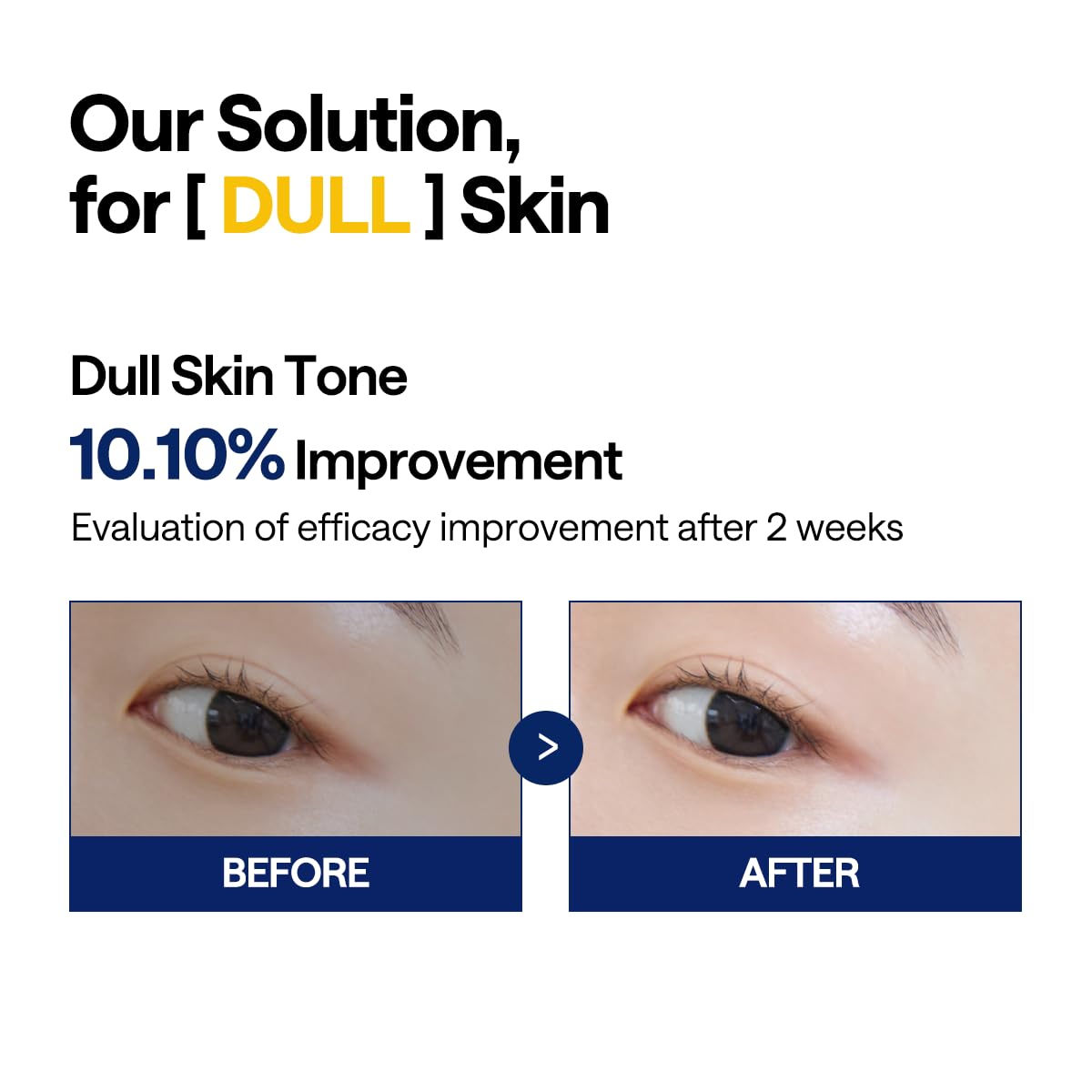 Application sur le visage avec les tampons tonifiants de Mediheal Vitamide.