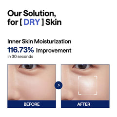Mediheal Watermide Pad effet frais sur peau sensible.