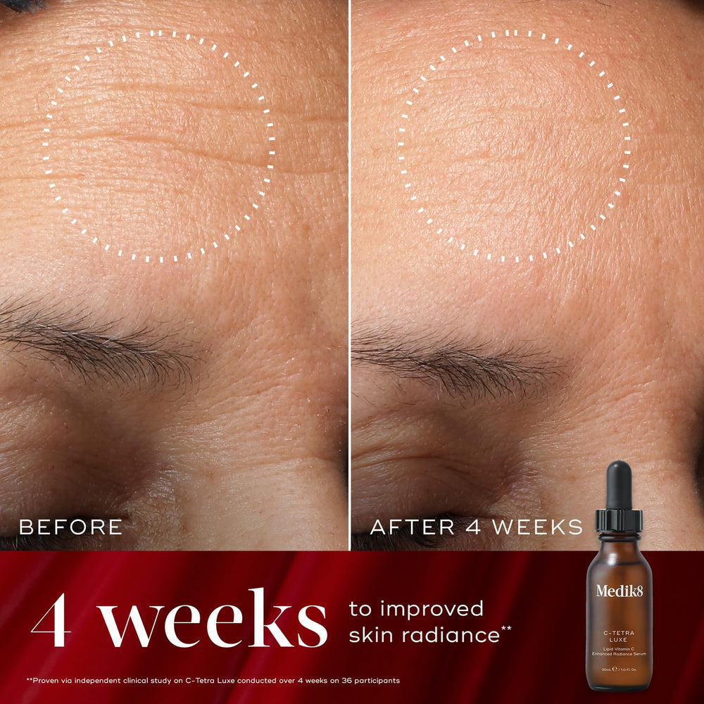 Sérum C-Tetra Luxe en action, application facile sur le visage.