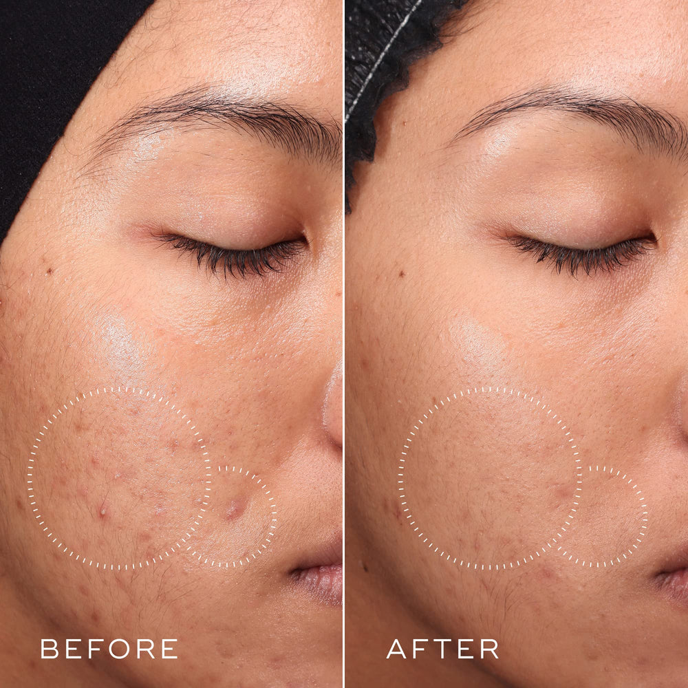 Medik8 Press et Clear: tonique à l'acide salicylique doux