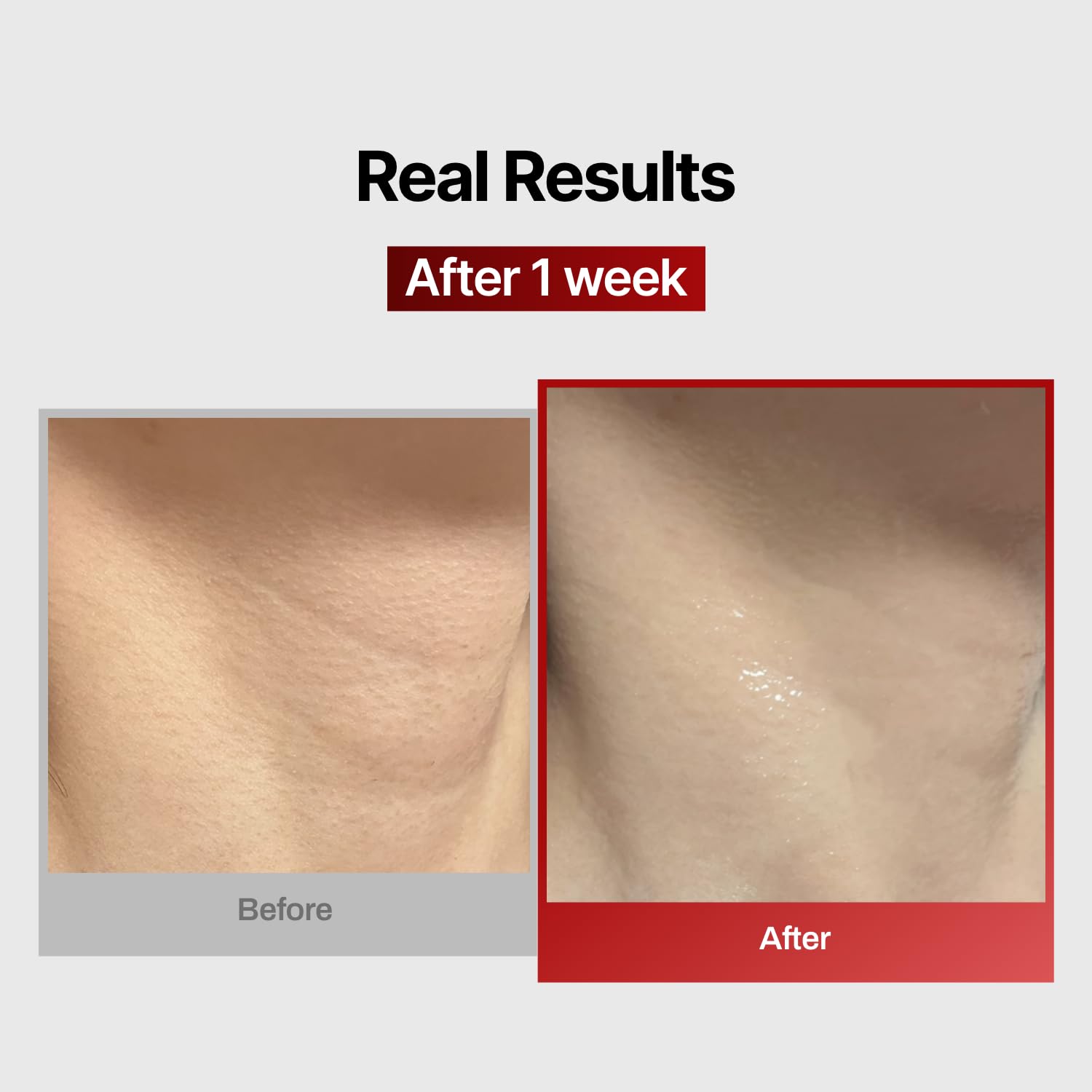MEDITHERAPY masque-cou à maillage, rouleau facial pour améliorer l’absorption et la fermeté.