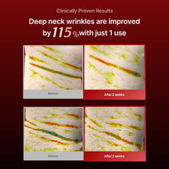 MEDITHERAPY masque-cou à maillage, maillage léger et texture qui nourrit la peau.