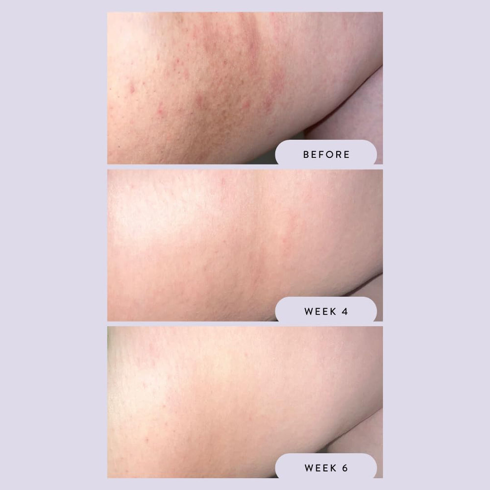 Megababe Night Rescue: camomille et vitamine E apaisants pour les irritations nocturnes.
