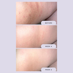 Megababe Night Rescue: camomille et vitamine E apaisants pour les irritations nocturnes.