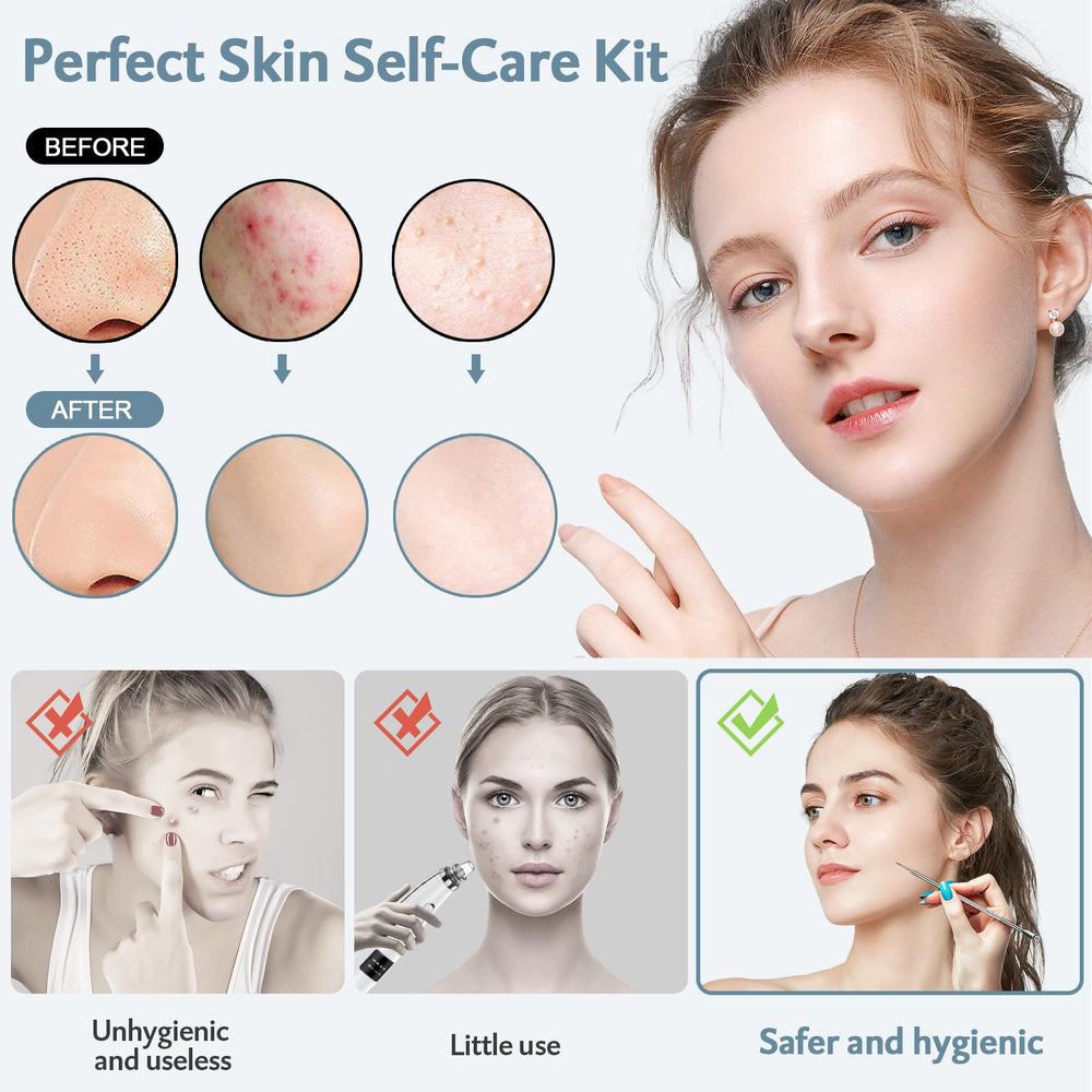 MENOLY outils extracteurs comédons visage – prise en main anti-glisse.