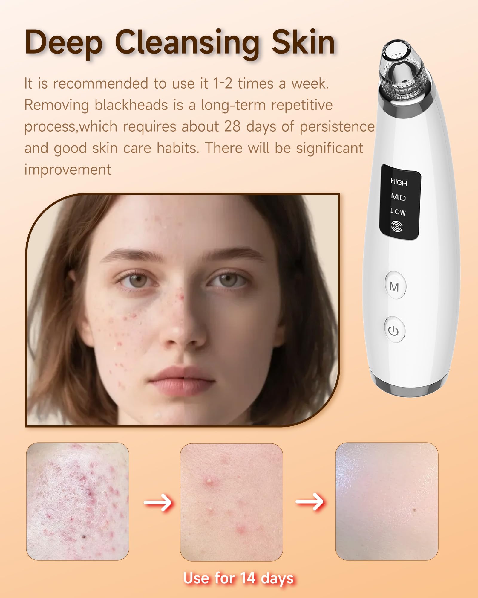 Miley ensemble sondes six – sondes spécialisées pour zones du visage.