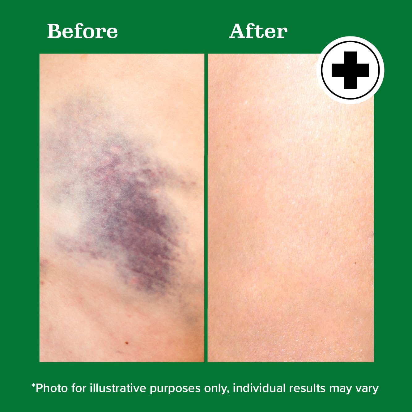 Formule non grasse Miracle Plus Arnica pour peau sensible.