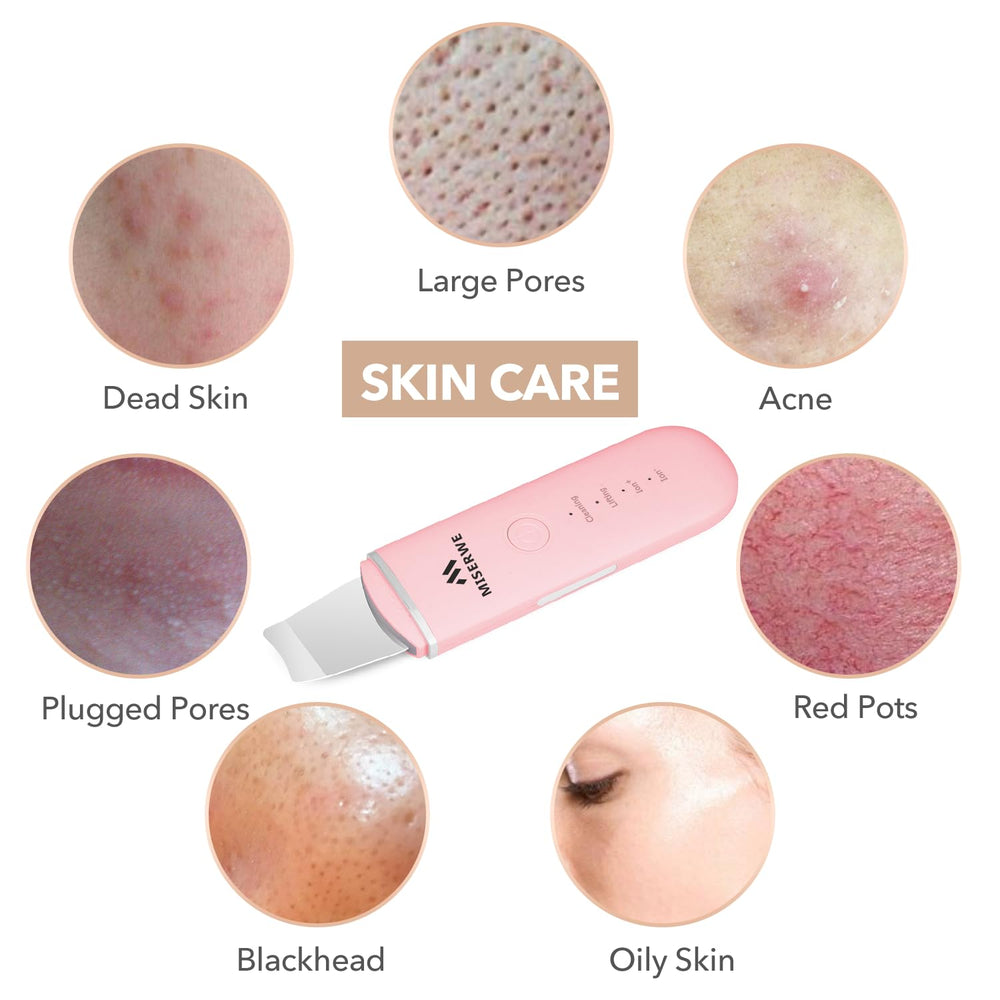MISERWE Spatule Ion- Rose — mode Ion- stimulant en douceur.