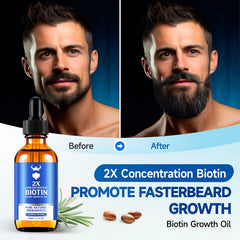 MistySprite Beard Growth Oil – Application douce pour masser la barbe.