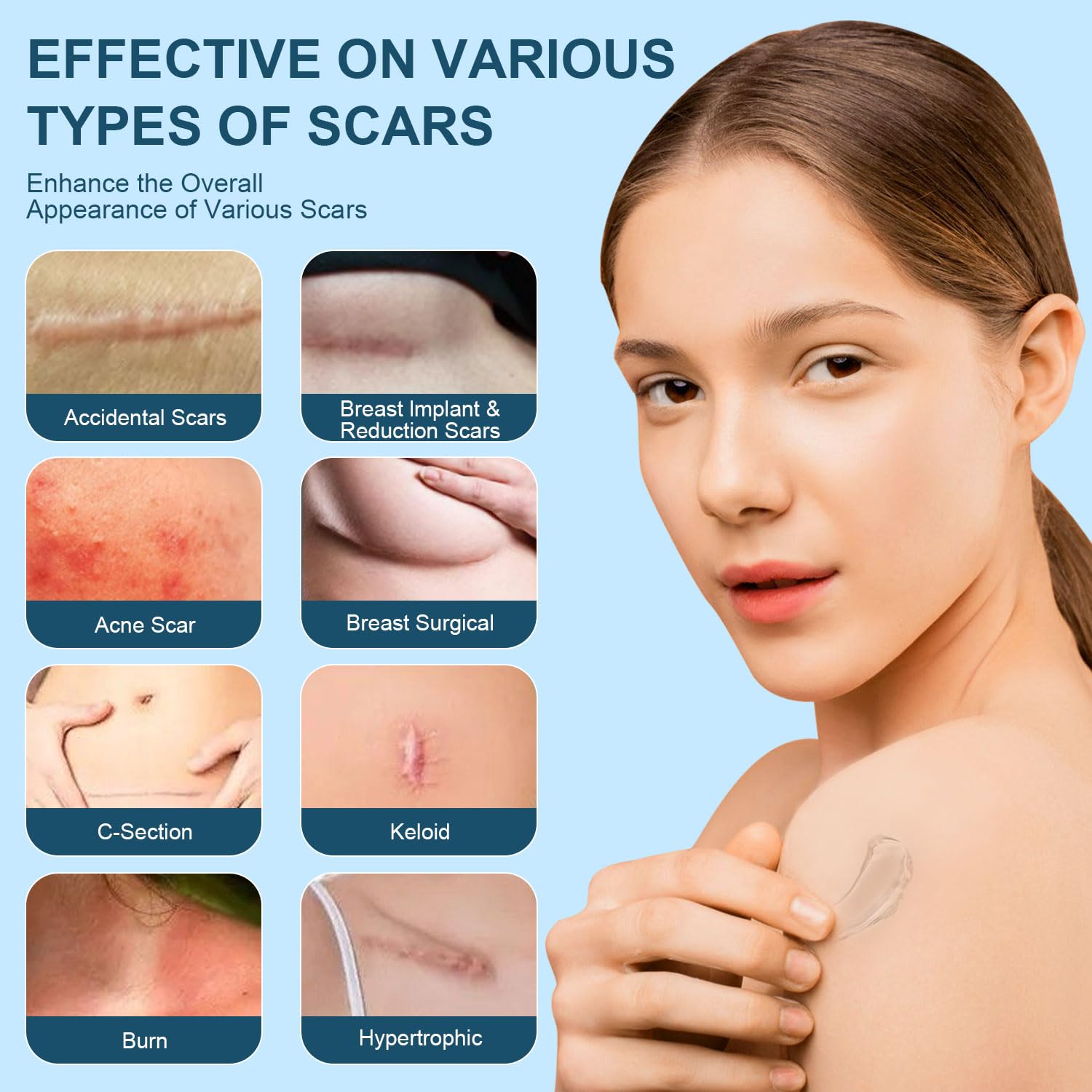 Mitgary Advanced Scar Gel : cicatrices nouvelles et anciennes visibles sur un avant-après.
