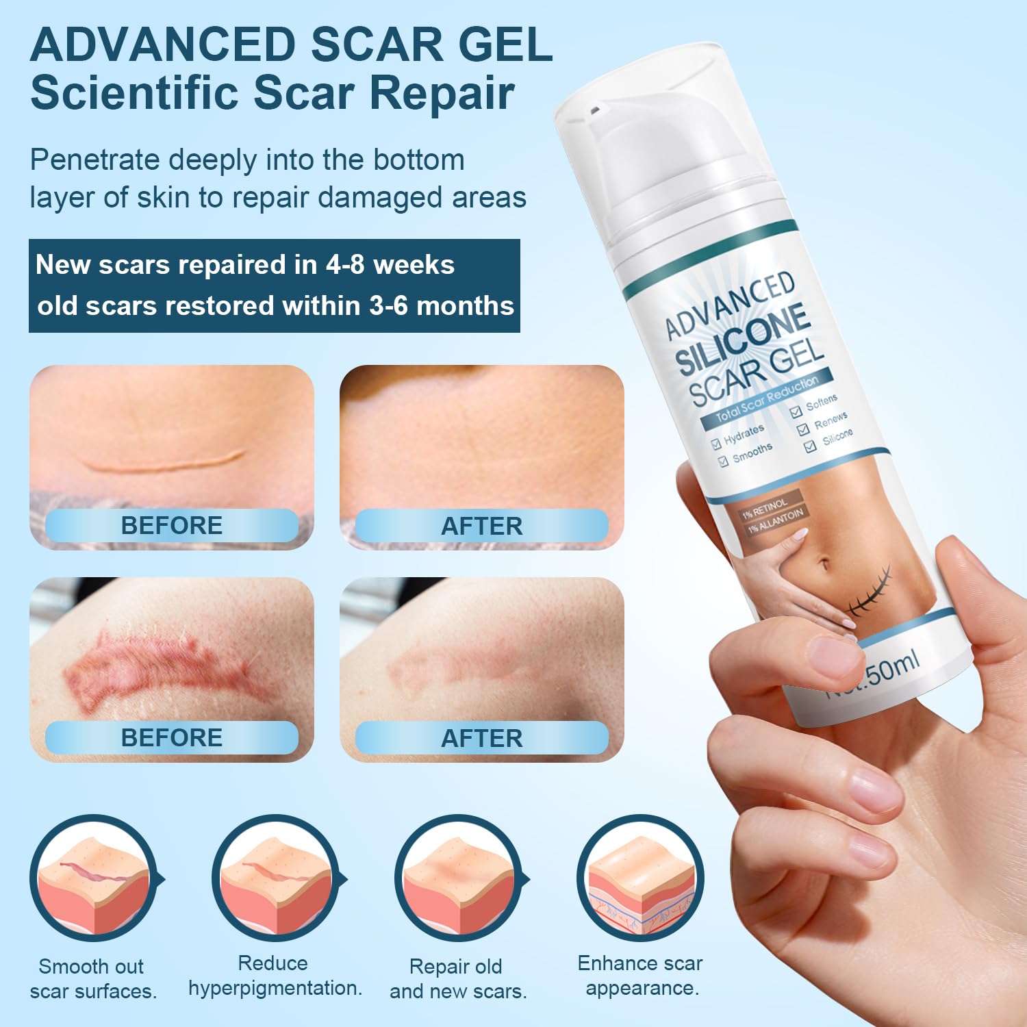 Mitgary Advanced Scar Gel : texture translucide non-gras sur la peau.