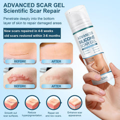 Mitgary Advanced Scar Gel : texture translucide non-gras sur la peau.