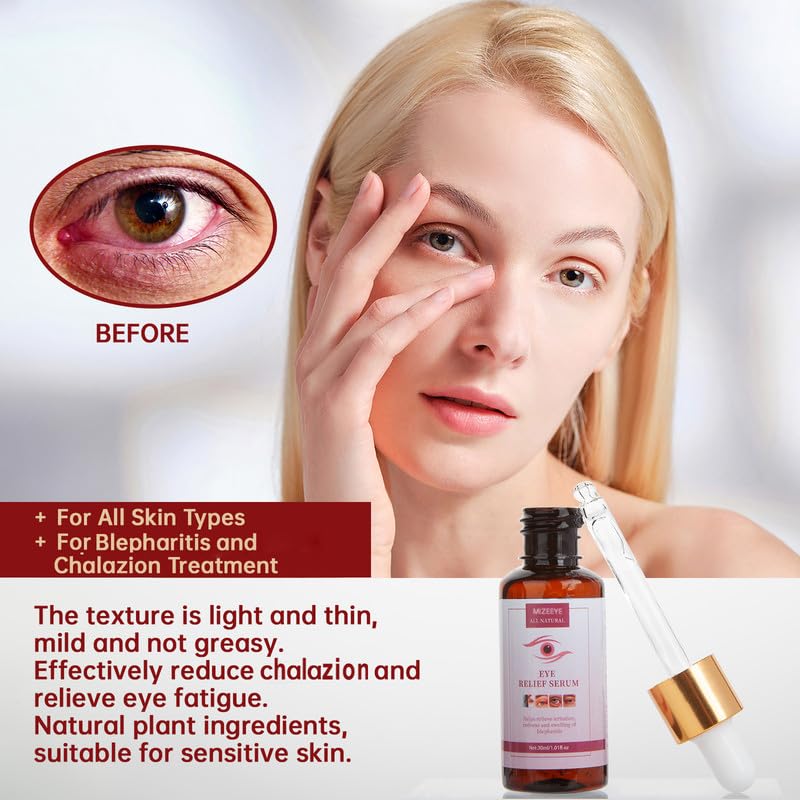 Gouttes MIZEEYE via pipette, dosage précis autour des yeux.