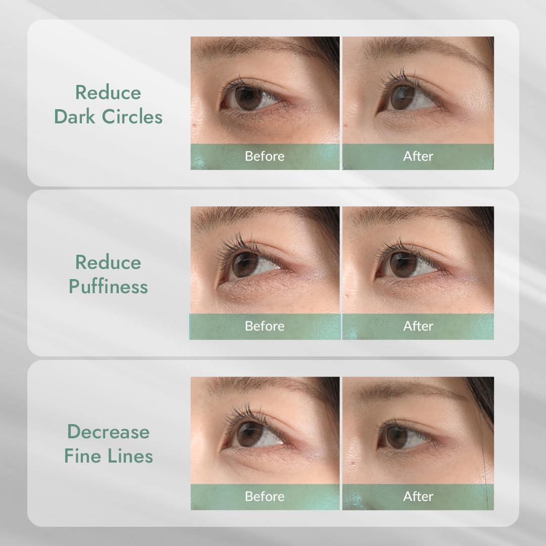 MIZON 24K Or Yeux Patch – touche luxueuse pour un regard rafraîchi.