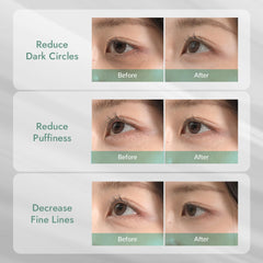 MIZON 24K Or Yeux Patch – touche luxueuse pour un regard rafraîchi.