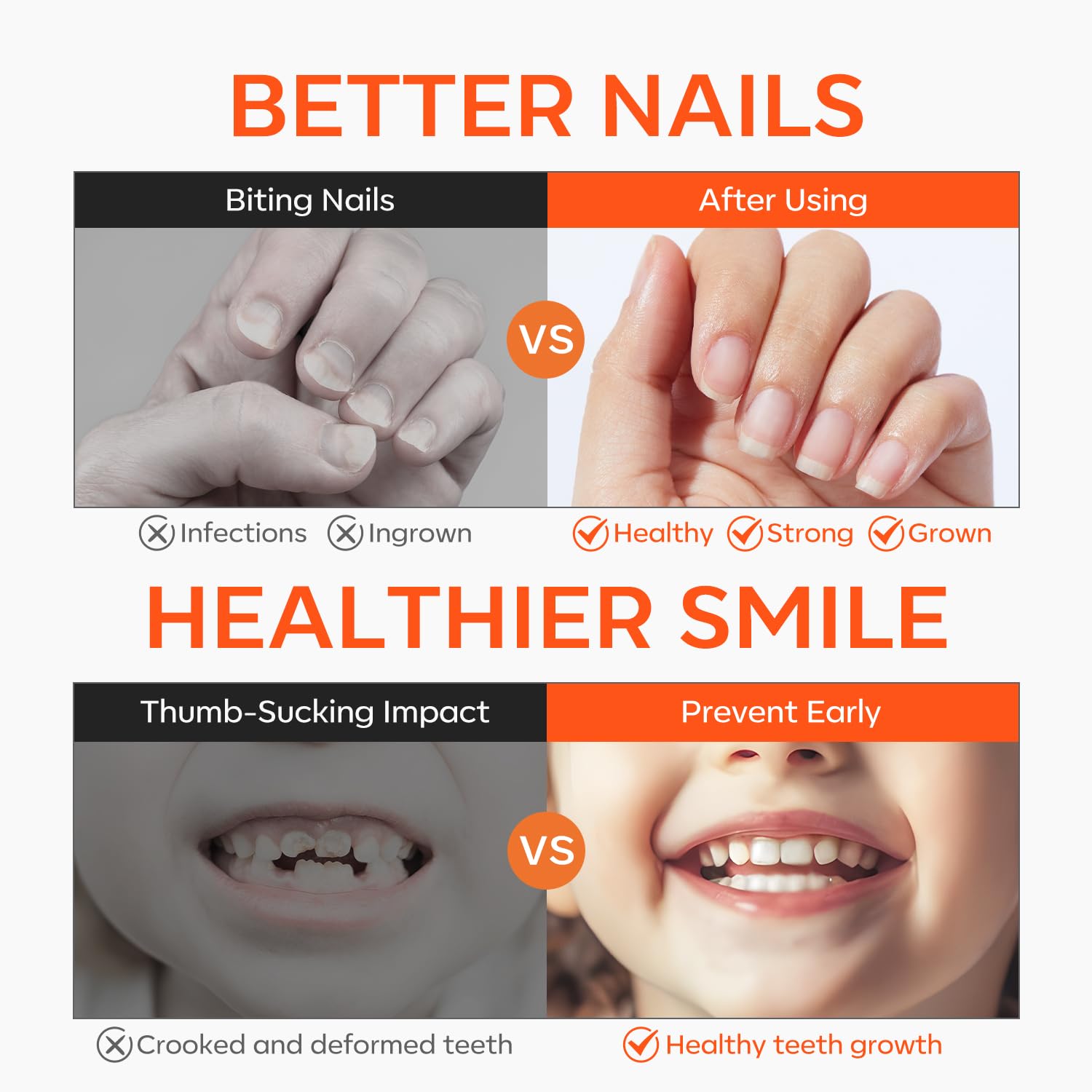 Modelones vernis arrêt rongement des ongles, goût amer efficace.