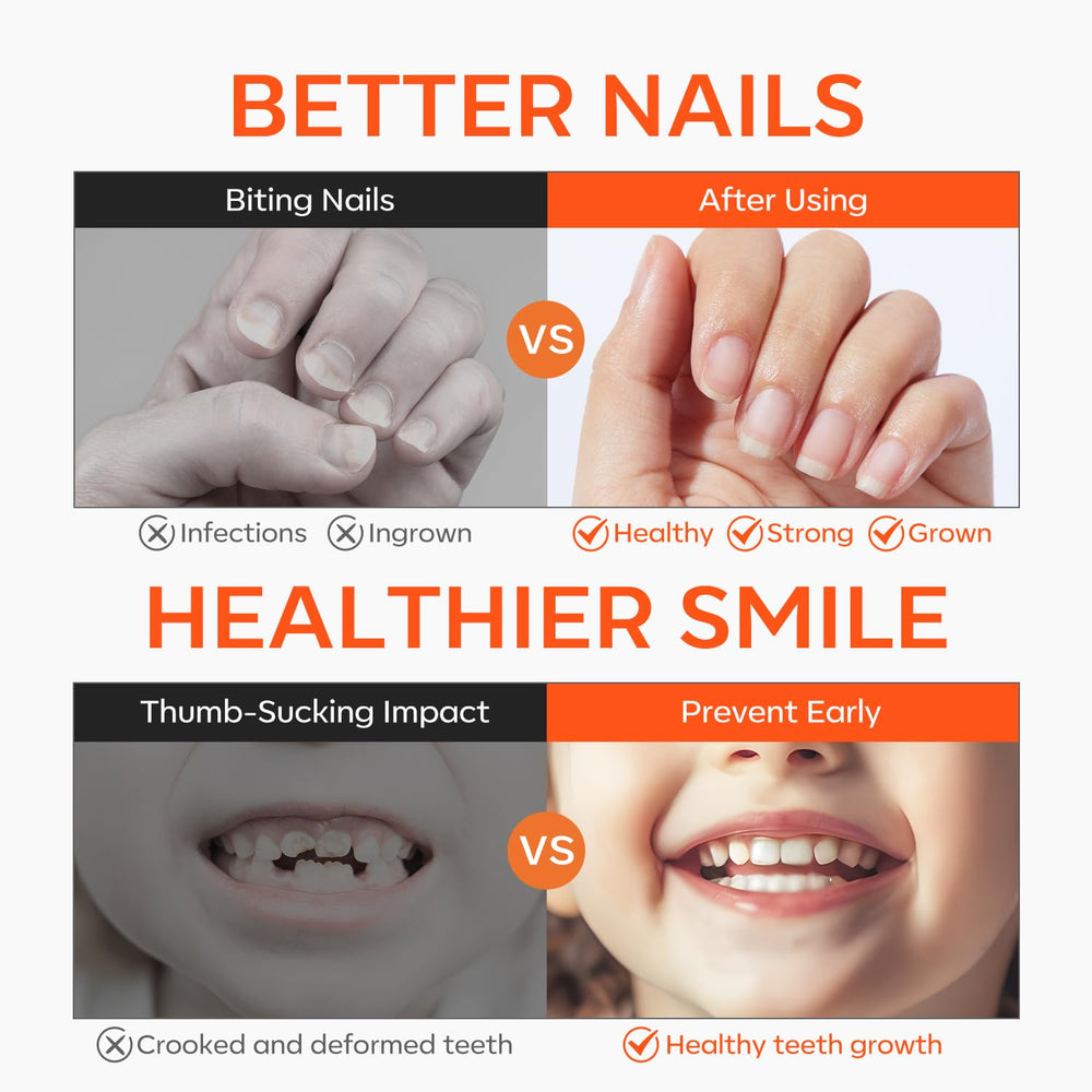 Modelones vernis arrêt rongement des ongles, goût amer efficace.