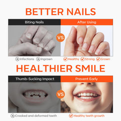 Modelones vernis arrêt rongement des ongles, goût amer efficace.