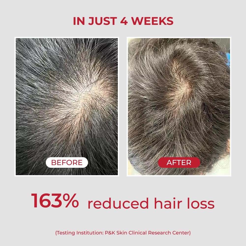 MOEV ANNURCATIN Shampoing — flacon démontrant l efficacite sur les cheveux manquant de volume.