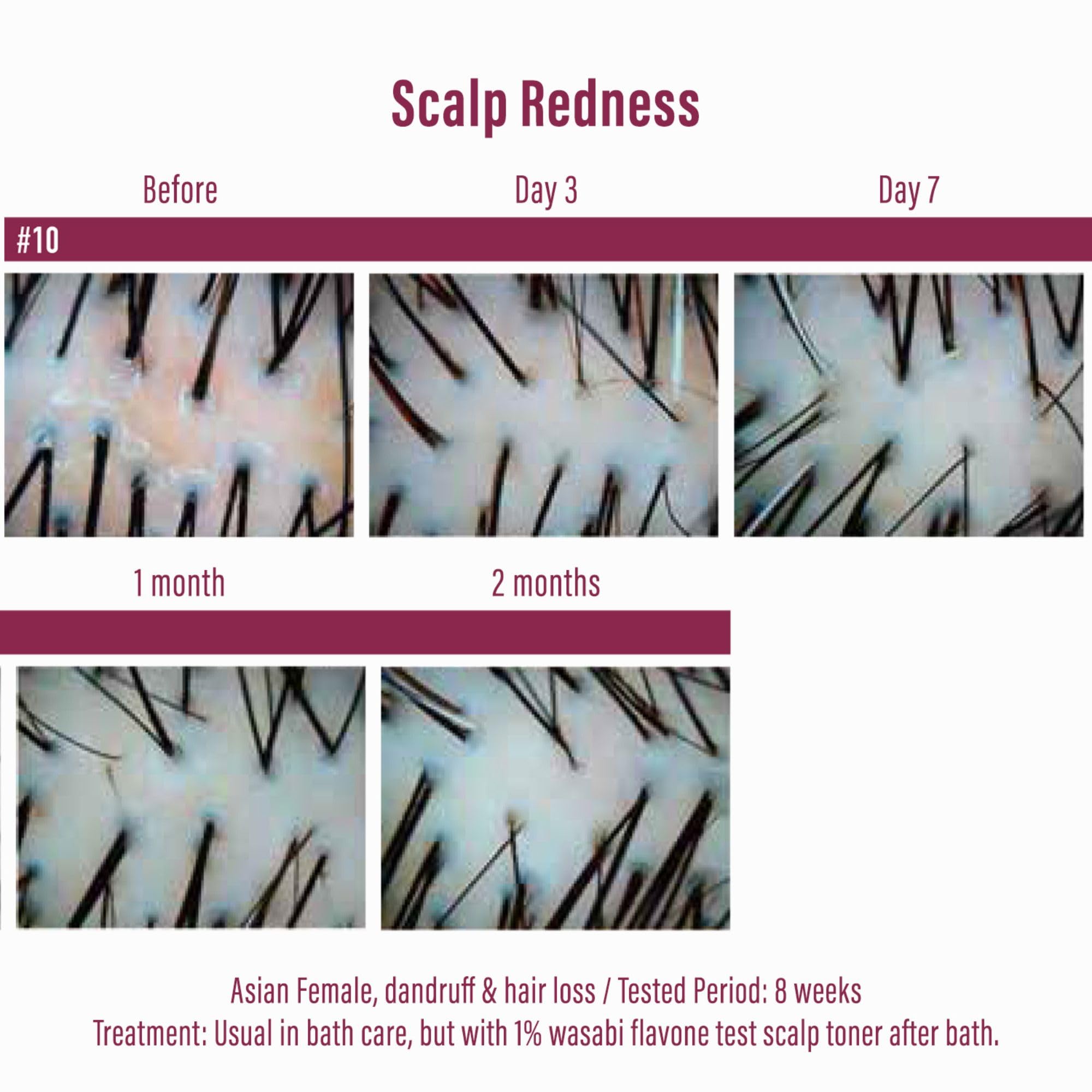 Extrait Wasabi Japonica Moist Diane favorise un cuir chevelu sain.