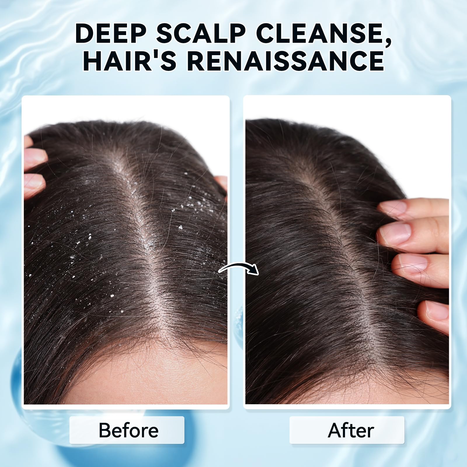 Mokasakiso exfoliation douce éliminant les résidus sur cuir-chevelu.