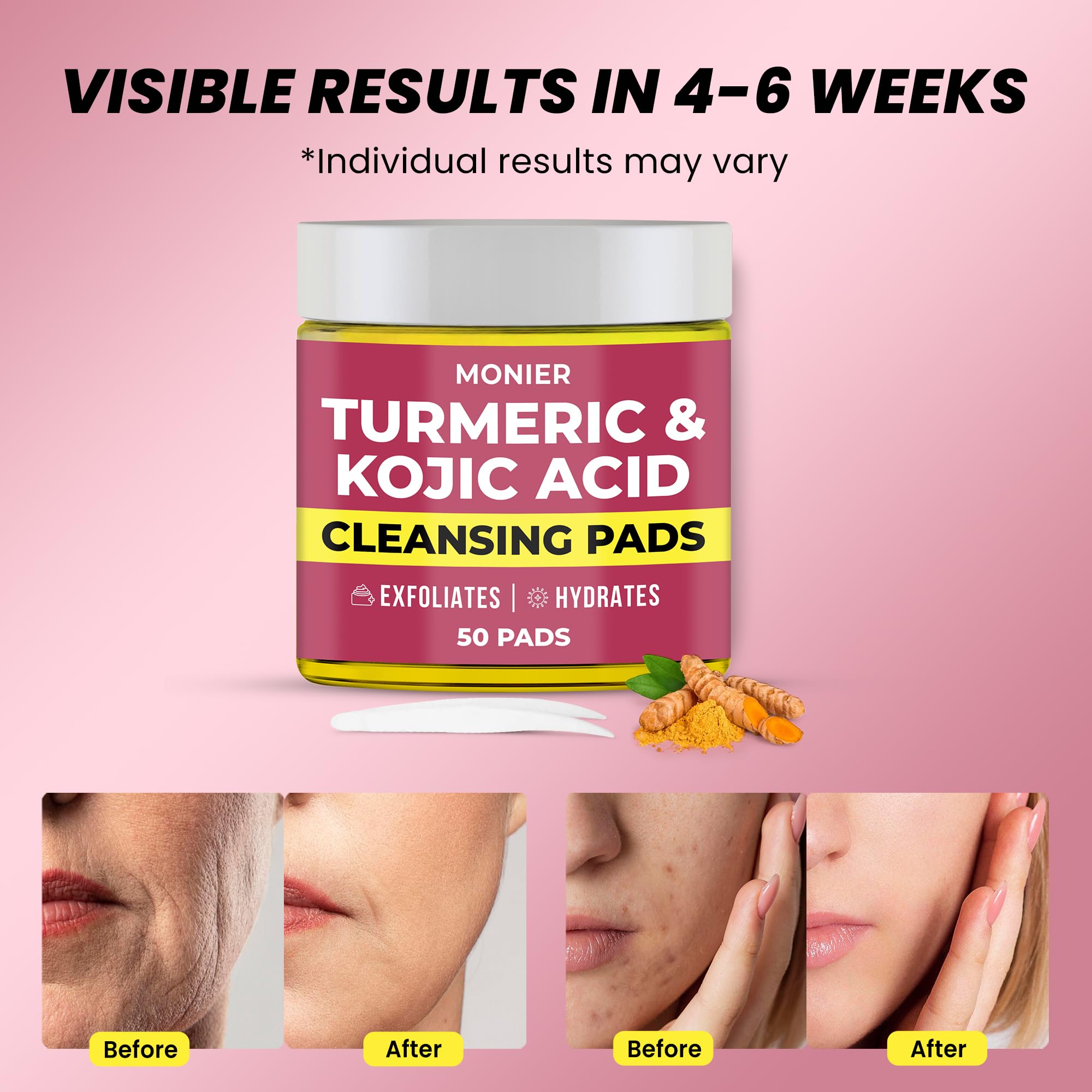 Tampon MONIER curcuma kojique visage, aide à purifier le teint.