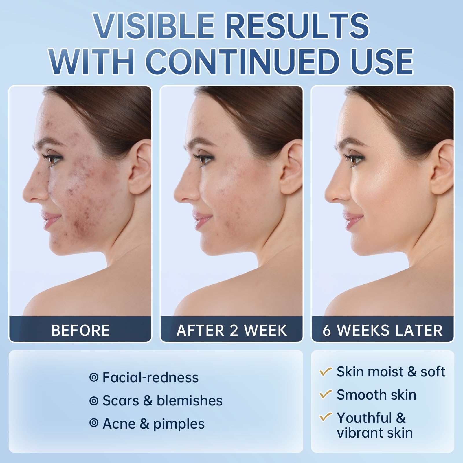 mopayzer usage quotidien visage: exfolie en douceur et nettoie