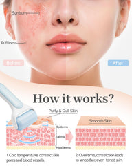 Rouleau glace MORGLES, contours du visage mieux dessinés grâce au massage frais.